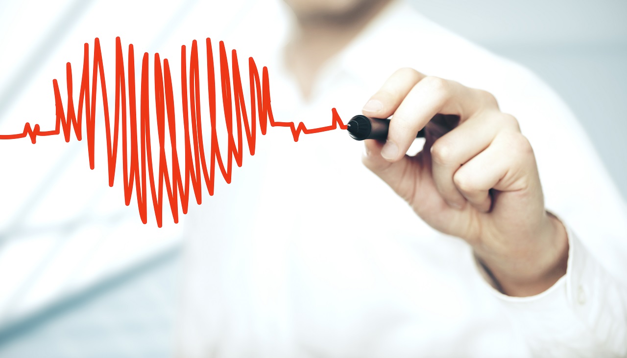 Procjena kardiovaskularnog rizika